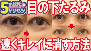 【美容医療（整形）のトリセツ】目の下のたるみをきれいに消す方法を5分で解説！【湘南美容クリニック】