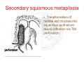 chronic suppurative otitis media-atticoantral,ent,class-4