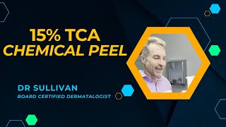 15% TCA Chemical Peel for Acne and Pigmentation #acne #chemicalpeels #brownspots #hyperpigmentation