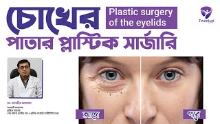 চোখের পাতার প্লাস্টিক সার্জারি । । Plastic surgery of the eyelids [4K]