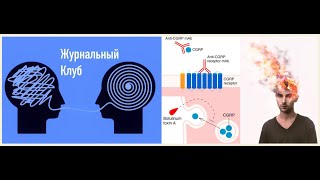 Неврологический журнальный клуб — 15-я встреча