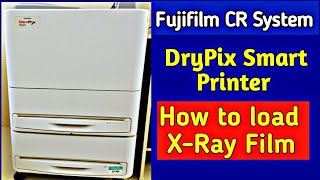 How to load Film in Fujifilm DryPix Smart Printer | Fujifilm CR System | UdayXray