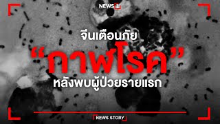 จีนเตือนภัย “กาฬโรค” หลังพบผู้ป่วยรายแรก : [News Story]