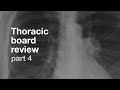 Board Review | Thoracic Radiology | Part 4