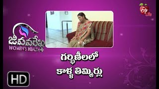 Jeevanarekha Women's Health | 21st January 2019 | జీవనరేఖ ఉమెన్స్ హెల్త్ | Full Episode