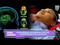 Bagaimana Diagnosis Untuk Skizofrenia Dilakukan | Helo Doktor (28 Jan 2024)