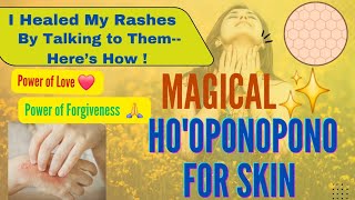 I Healed my Skin Rashes with this Powerful Ho'oponopono Prayer #HooponoponoForSkin |Hamsalatha Ravi