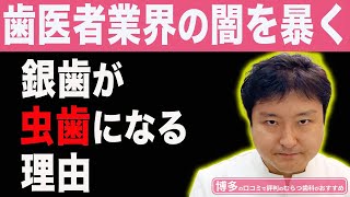 【福岡 博多の口コミで評判の歯科医のおすすめ】なぜ銀歯は虫歯になるのか？福岡の現役歯医者が銀歯が虫歯になる理由を徹底解説。これから歯科治療をやりたい方におすすめです。