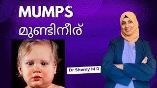 MUMPS: Reasons \u0026 Remedies| മുണ്ടിനീര് കാരണങ്ങള്‍ പരിഹാര മാര്‍ഗങ്ങള്‍ എന്തൊക്കെയാണ്| Dr Shemy