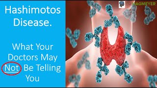Hashimotos What IS It? and What Your Doctor May NOT Be Telling You!
