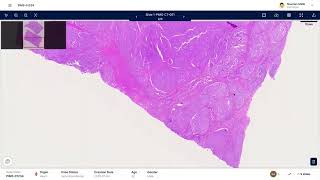 PRAID AI Pathology Demo