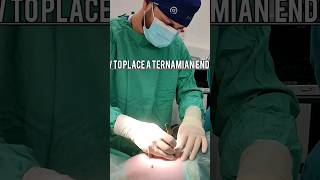 How to place a Ternamian Endotip System