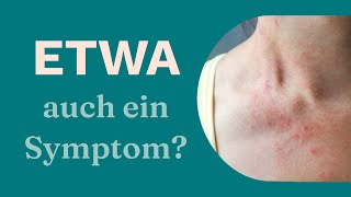 Neues Corona-Symptom: Studien belegen Hautausschlag