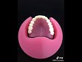 CAD/CAM full denture