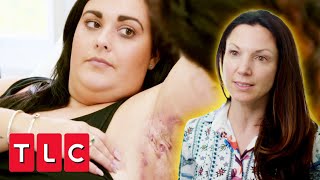 Dr Emma Treats Woman with Chronic Abscesses That Could Burst Any Moment! | The Bad Skin Clinic