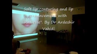 Advanced Lip Augmentation Training Part.1 | London Lipo Institute