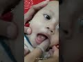 3 alat pembersih lidah bayi