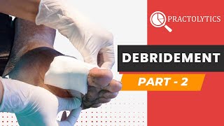 Debridement Coding Guidelines - Part 2 - CPT Codes to Use | Practolytics