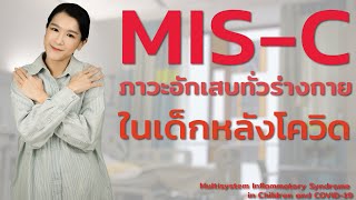 MIS-C ภาวะอักเสบทั่วร่างกายในเด็กหลังติดโควิด Multisystem Inflammatory Syndrome in Children COVID-19