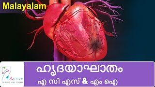 Heart Attack (ACS & MI) | Malayalam