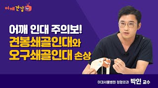 어깨 인대 주의보! 견봉쇄골인대와 오구쇄골인대 손상