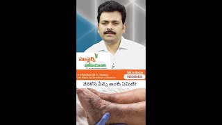 వేరికోస్ వీన్స్ అంటే ఏమిటి ? Masters homeopathy Dr Ravikiran