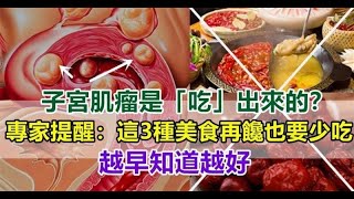 40歲女子患上子宮肌瘤，都是「吃」惹的禍，專家提醒：3種食物再不忌口，小心「腫塊」越喂越大！