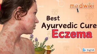 Ayurvedic Treatment for Eczema!