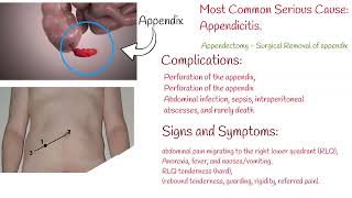 Pain in Lower Right Abdomen - causes and symptoms