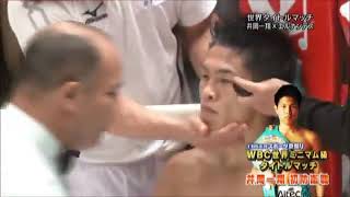 井岡一翔vsファン・エルナンデス　WBC世界ミニマム級タイトルマッチ　Kazuto Ioka vs Juan Hernandez　full fight　#boxing #ボクシング