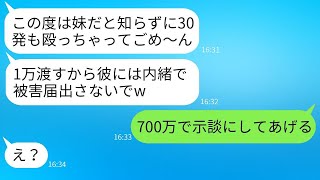 家に帰ると、兄の彼女が勘違いして私を30回も殴ってきた。「この泥棒女！」と言いながら。私が妹だと知ったアホ女の言い訳がひどすぎるwww。