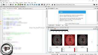 Brain Tumor Classification in MRI dataset Using Support Vector Machine Using PYTHON