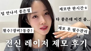 머리통 아래로 털 없는 삶 후기.. 전신 레이저 제모 후 치명적인 단점 한가지