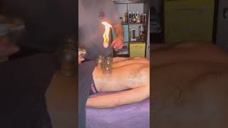 Fire cupping for back pains #shorts #cupping #hijama #pain