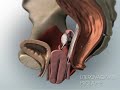 Animated female pelvic organ prolapse