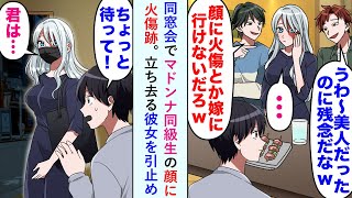 【漫画】同窓会でマドンナ同級生の顔に火傷跡があり、同級生男「あの美人が残念だなww」立ち去る彼女を引止め俺「生まれ変わりませんか？」マドンナ「え？」【恋愛マンガ動画】