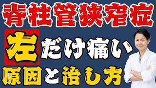 【脊柱管狭窄症 左だけ痛い】左だけ足腰に痛みがある人の原因と自分で治す方法 長野県松本市の脊柱管狭窄症専門 整体院千与香