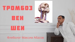 Тромбоз яремной вены. Как лечить. Флеболог Москва