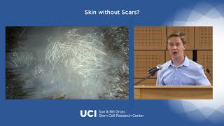 Skin without Scars? - Presented by Maksim Plikus and Victor Joe