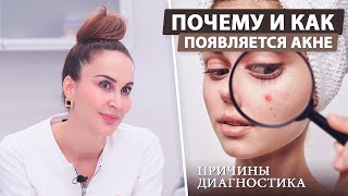 Почему и как возникает акне?