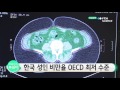 한국 성인 비만율 oecd 최저