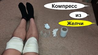 Компресс с желчью при артрозе сустава. Медицинская желчь при болях в суставах как применять?