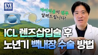 렌즈삽입술 후 노년기 백내장수술방법