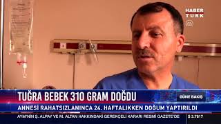 Tuğra bebek 310 gram doğdu