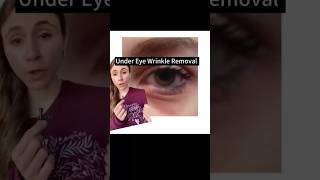 Under Eye Wrinkle Skincare Trick You Need To Try! #dermatologist