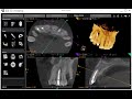 cbct in periodontics