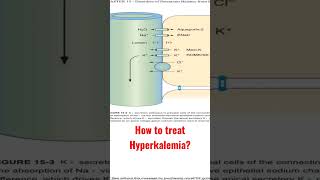 How to treat hyperkalemia?