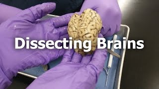 Dissecting Brains