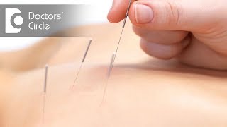 How long do the effects of acupuncture last? - Dr. Gurudatta H K