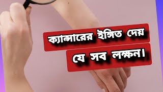 যে ১০ লক্ষন ক্যা-ন্সারের ইঙ্গিত দেয়।